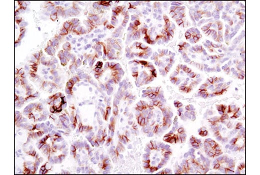 Immunohistochemistry Image 6: Phospho-Met (Tyr1234/1235) (D26) XP<sup>®</sup> Rabbit mAb (BSA and Azide Free)