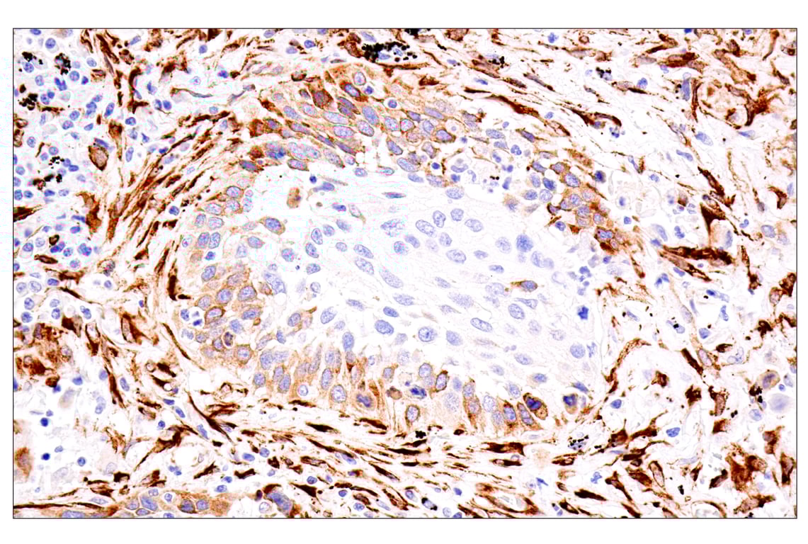 Immunohistochemistry Image 3: HSP47/SERPINH1 (E4A8P) Rabbit mAb