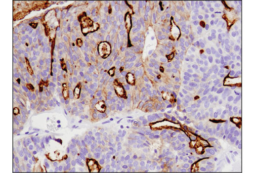 Immunohistochemistry Image 4: CD133 (D2V8Q) XP<sup>®</sup> Rabbit mAb