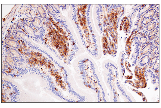 Immunohistochemistry Image 5: Semaphorin-4D/CD100 (E5C3B) XP<sup>®</sup> Rabbit mAb