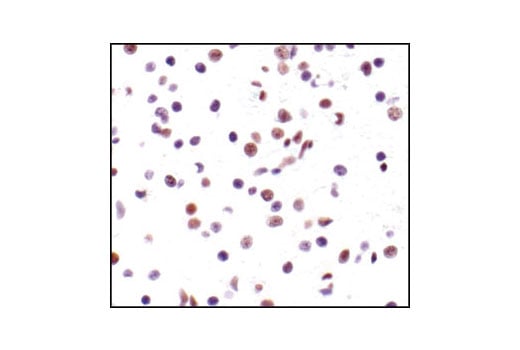 undefined Image 6: PhosphoPlus<sup>®</sup> CREB (Ser133) Antibody Duet