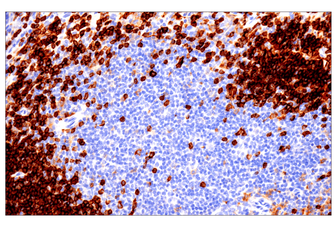 Immunohistochemistry Image 2: CD22 (F9D1W) Rabbit mAb (BSA and Azide Free)