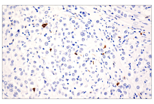 Immunohistochemistry Image 1: CD20 (E7B7T) XP<sup>®</sup> Rabbit mAb (BSA and Azide Free)