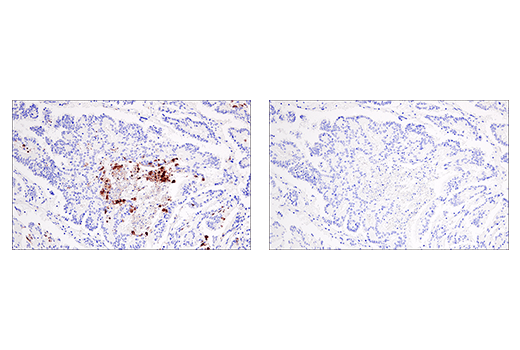 undefined Image 29: Human Reactive PANoptosis Antibody Sampler Kit