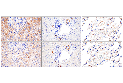 Immunohistochemistry Image 2: NG2/CSPG4 (E3B3G) XP<sup>®</sup> Rabbit mAb (BSA and Azide Free)