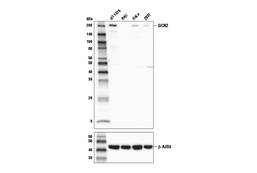 undefined Image 1: PhosphoPlus <sup>®</sup> GCN2 (Thr899) Antibody Duet