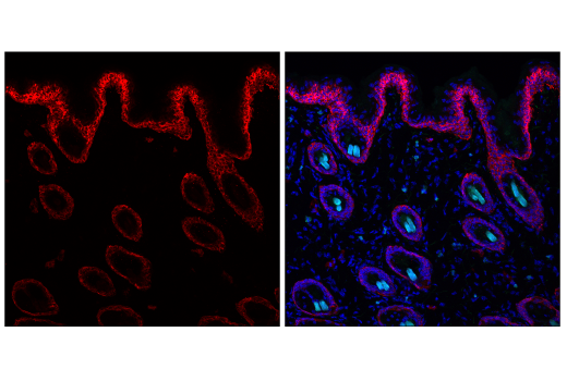 Immunofluorescence Image 1: Keratin 5 (E2T4B) XP<sup>®</sup> Rabbit mAb