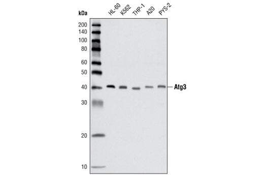 undefined Image 4: Autophagy Vesicle Elongation (LC3 Conjugation) Antibody Sampler Kit