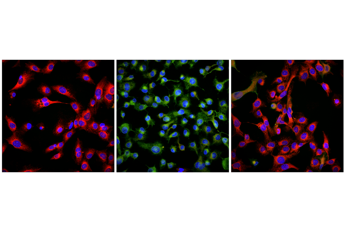 Immunofluorescence Image 1: BODIPY 581/591 C11 (Lipid Peroxidation Sensor)