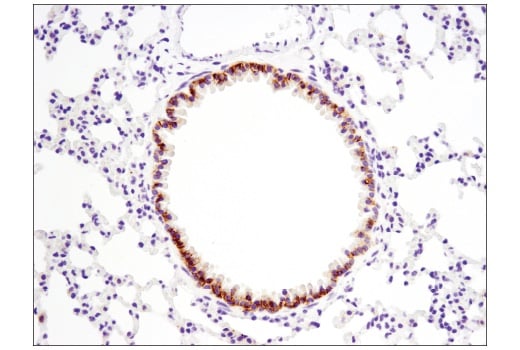 Immunohistochemistry Image 3: EpCAM (E6V8Y) XP<sup>®</sup> Rabbit mAb (BSA and Azide Free)