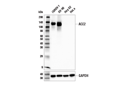 undefined Image 13: SARS-CoV-2 Virus-Host Interaction Antibody Sampler Kit