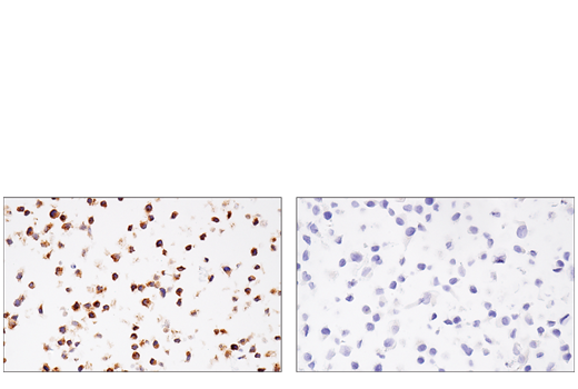 Immunohistochemistry Image 3: CSF-1R/M-CSF-R (E4T8Z) Rabbit mAb