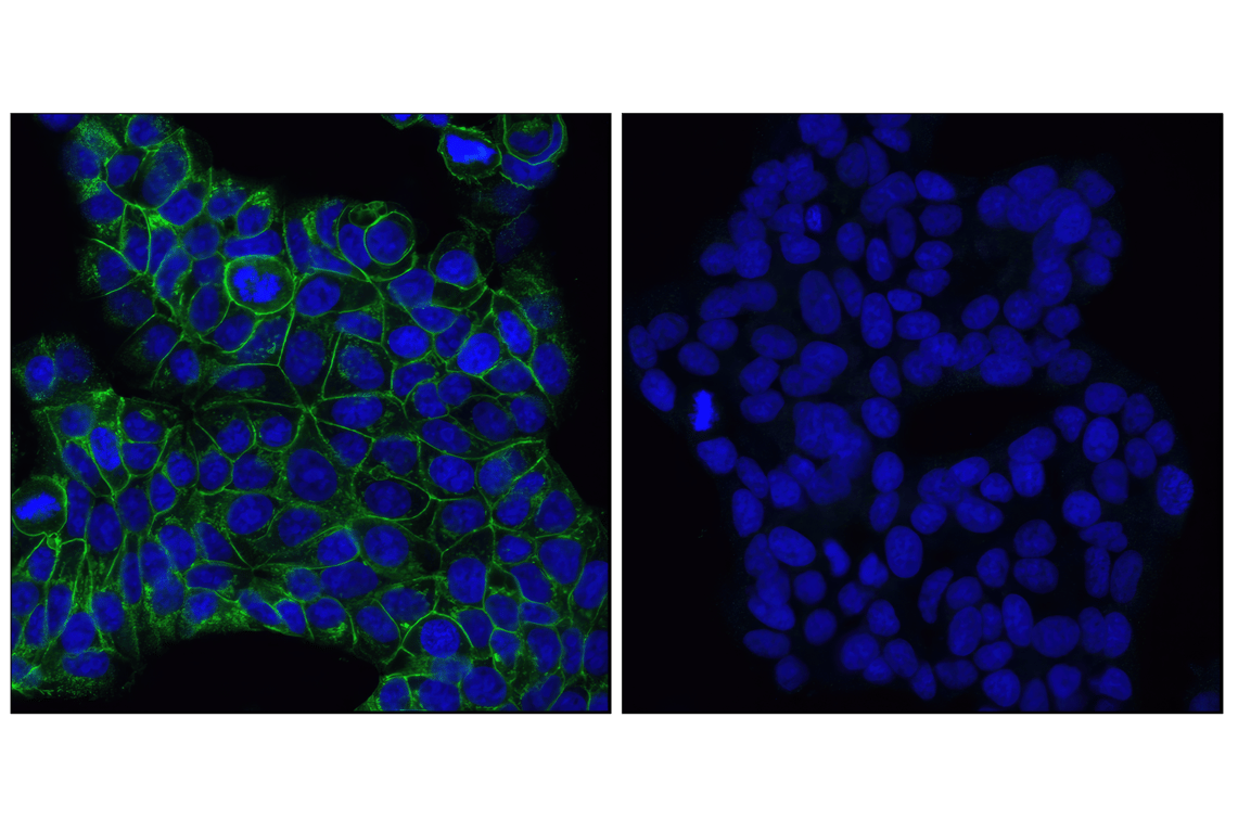 undefined Image 38: Cadherin-Catenin Antibody Sampler Kit
