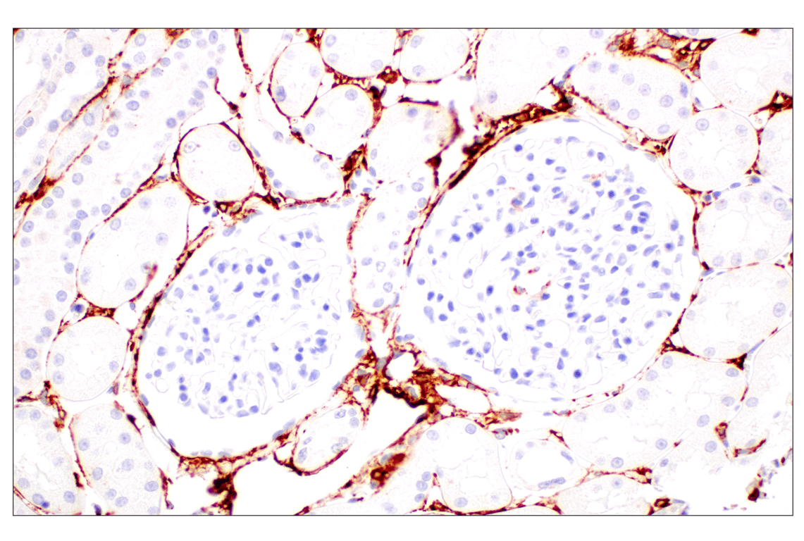 Immunohistochemistry Image 8: α-Smooth Muscle Actin (D4K9N) XP<sup>®</sup> Rabbit mAb (BSA and Azide Free)