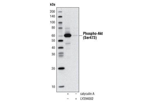 Western Blotting Image 1: Phospho-Akt (Ser473) (D9E) XP<sup>®</sup> Rabbit mAb (Biotinylated)