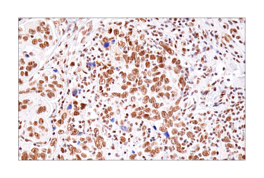 Immunohistochemistry Image 2: BRD4 (E2A7X) Rabbit mAb