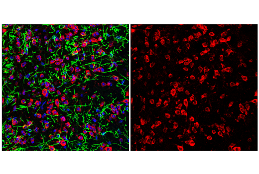 Immunofluorescence Image 2: YTHDF2 (E2I2H) Rabbit mAb