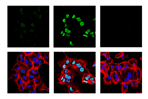 Immunofluorescence Image 1: Phospho-c-Jun (Ser63) (E6I7P) XP<sup>®</sup> Rabbit mAb