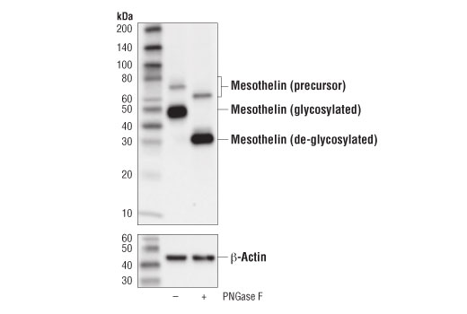 Western Blotting Image 2: Mesothelin (D9R5G) XP<sup>®</sup> Rabbit mAb (BSA and Azide Free)