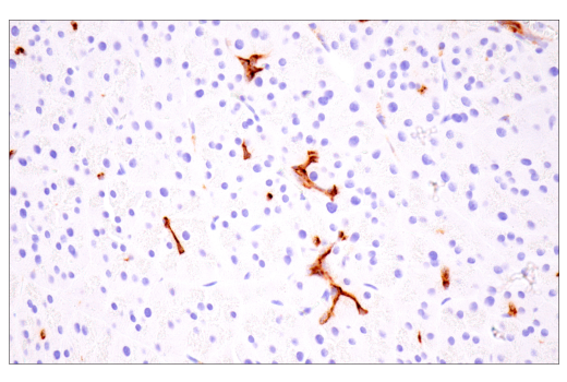 Immunohistochemistry Image 2: Osteopontin/SPP1 (E9Z1D) Rabbit mAb