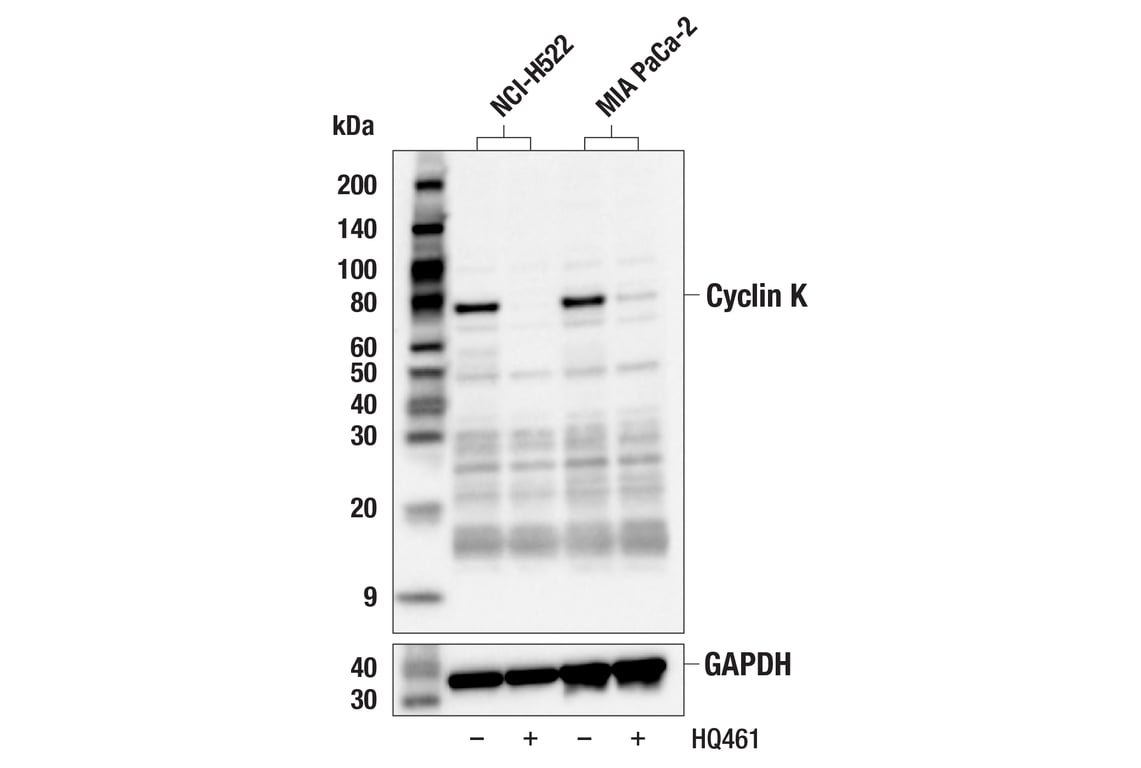 Western Blotting Image 2: Cyclin K (E7F4N) Rabbit mAb