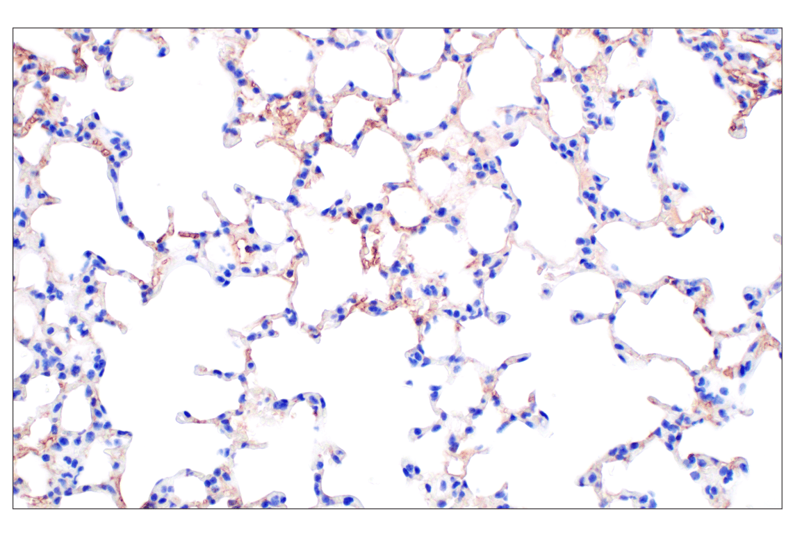 Immunohistochemistry Image 5: PNPLA3 (E7N6O) Rabbit mAb (BSA and Azide Free)