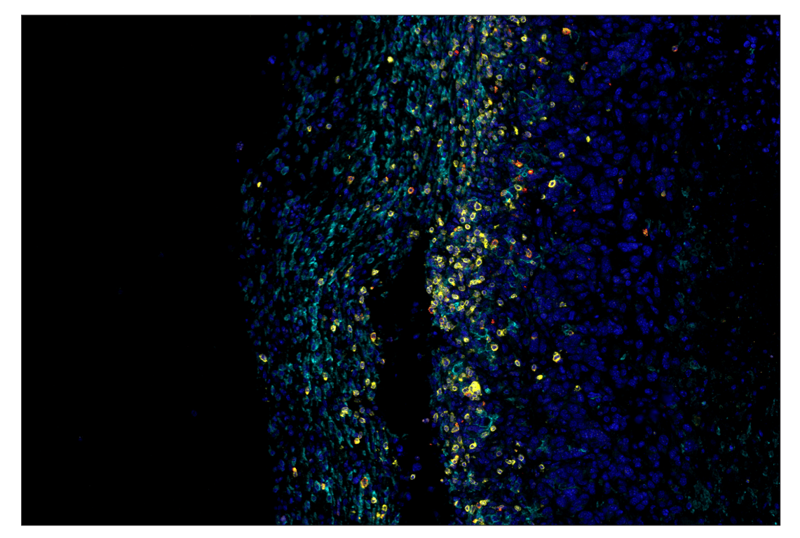 Immunohistochemistry Image 7: CD3ε (E4T1B) & CO-0048-594 SignalStar<sup>™</sup> Oligo-Antibody Pair