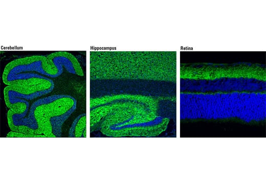 Immunofluorescence Image 1: Bassoon (D63B6) Rabbit mAb
