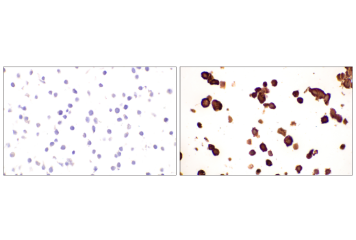 Immunohistochemistry Image 2: SARS-CoV-2 Nucleocapsid Protein (HL344) Rabbit mAb
