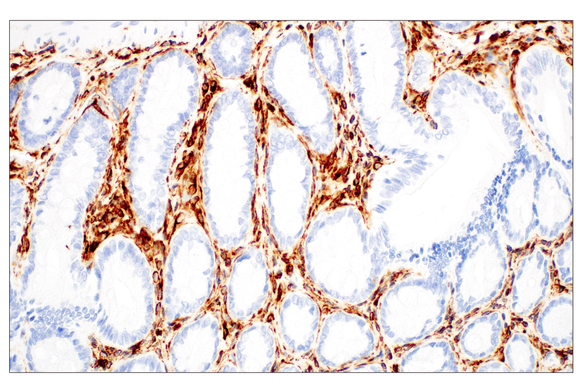 Immunohistochemistry Image 3: Vimentin (D21H3) XP<sup>®</sup> Rabbit mAb (BSA and Azide Free)