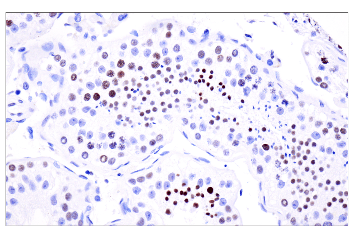Immunohistochemistry Image 7: Acetyl-Histone H4 (Lys16) (E2B8W) Rabbit mAb