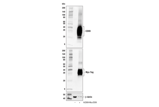 Western Blotting Image 2: CD69 (E1U2O) Rabbit mAb