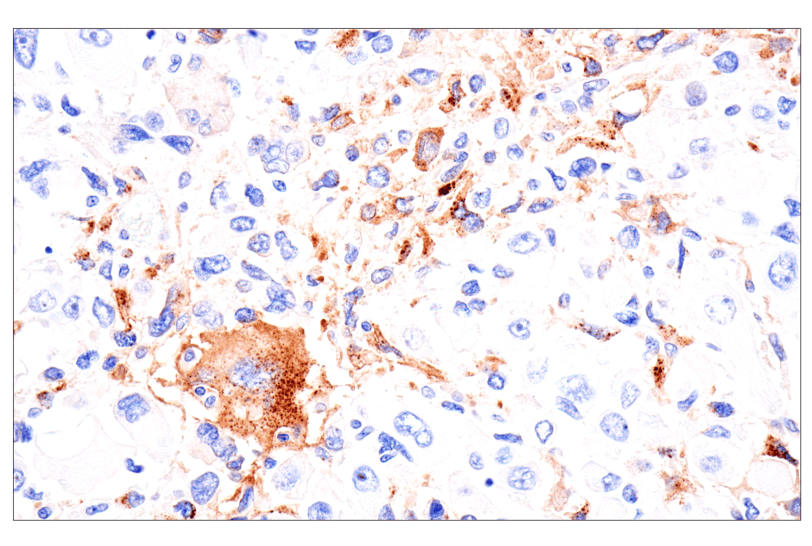 Immunohistochemistry Image 12: FAP (F1A4G) Rabbit mAb