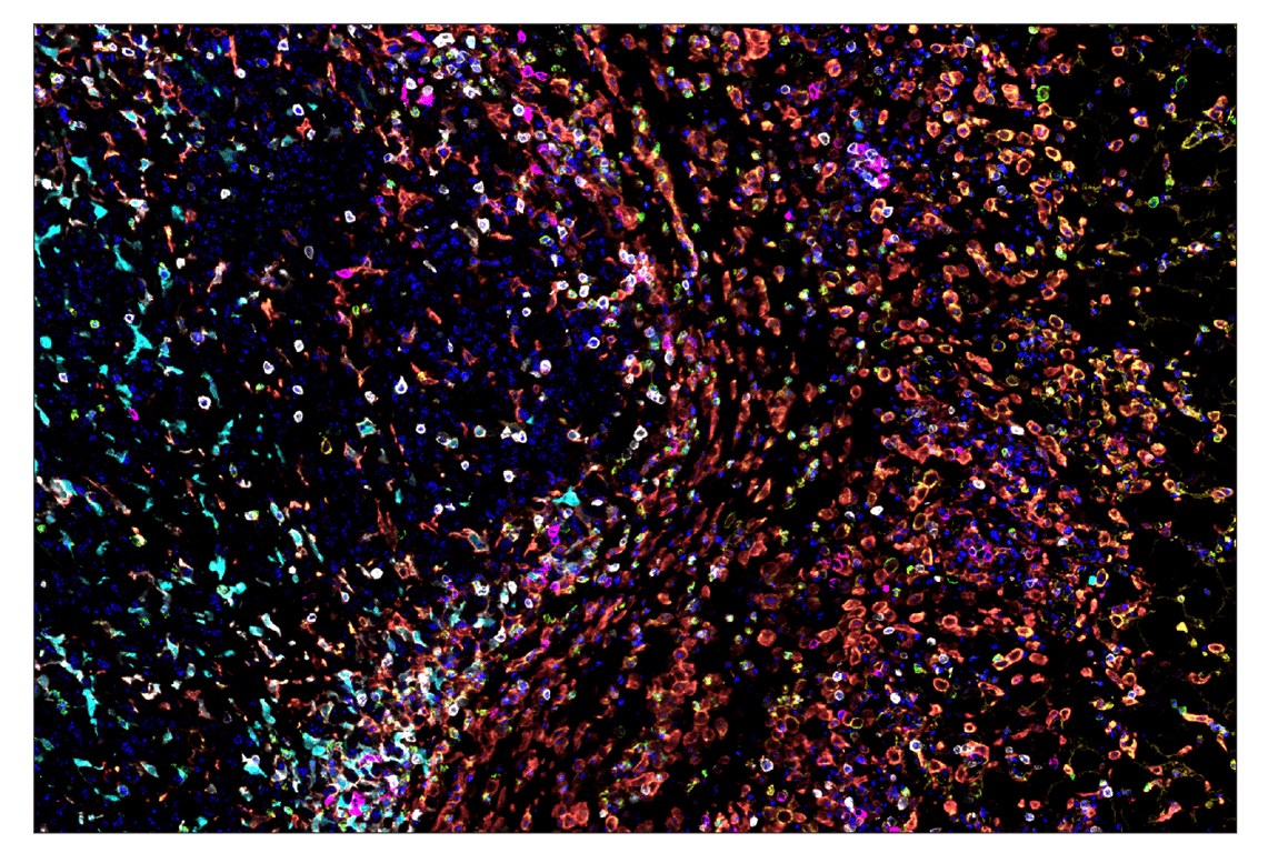 Immunohistochemistry Image 7: IL-2Rα/CD25 (E9W2J) & CO-0074-488 SignalStar<sup>™</sup> Oligo-Antibody Pair