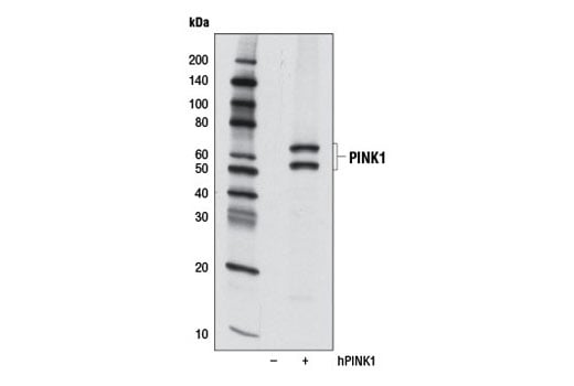 Western Blotting Image 1: PINK1 (D8G3) Rabbit mAb