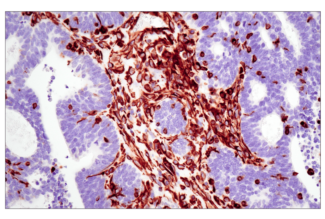 undefined Image 29: Cell Fractionation Antibody Sampler Kit