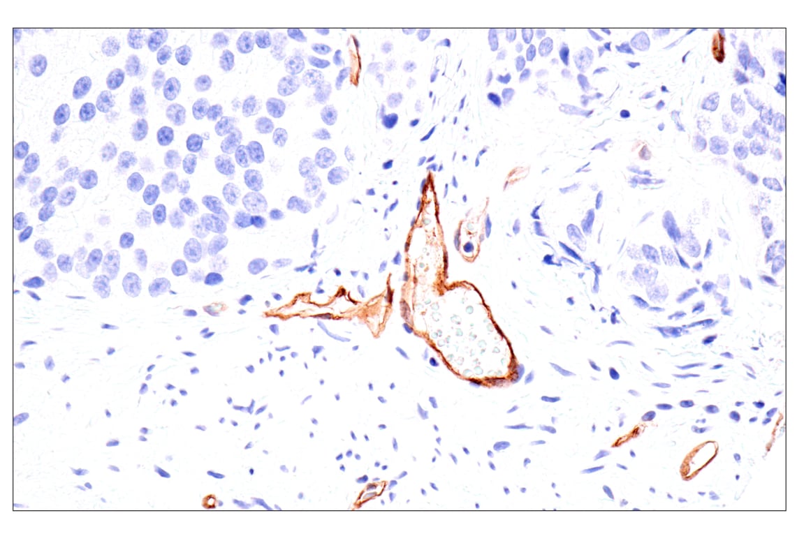 Immunohistochemistry Image 4: Claudin-5 (E5D9Y) Rabbit mAb