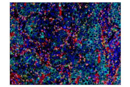 Immunohistochemistry Image 5: CD68 (D4B9C) XP<sup>®</sup> Rabbit mAb (BSA and Azide Free)