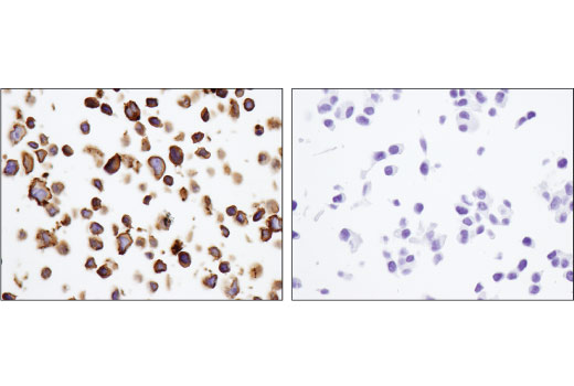 Immunohistochemistry Image 3: CD40 (D8W3N) Rabbit mAb