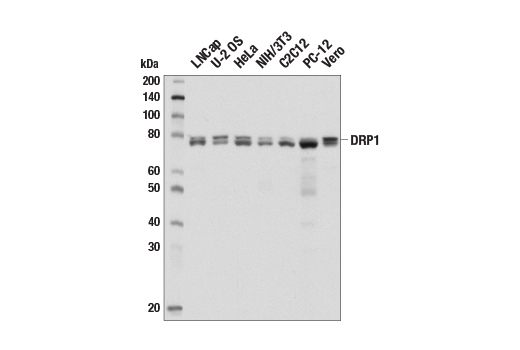 Western Blotting Image 1: DRP1 (D6C7) Rabbit mAb (BSA and Azide Free)