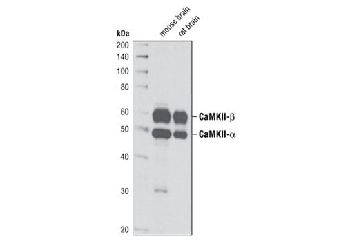 Western Blotting Image 2: CaMKII (pan) (D11A10) Rabbit mAb