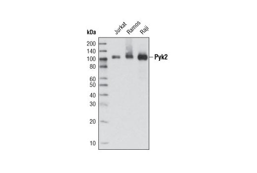 undefined Image 2: Late-Onset Alzheimer's Disease Risk Gene (Mouse Model) Antibody Sampler Kit