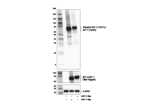 Western Blotting Image 2: Phospho-ATF-2 (Thr71)/ATF-7 (Thr53) (E4A5G) XP<sup>®</sup> Rabbit mAb