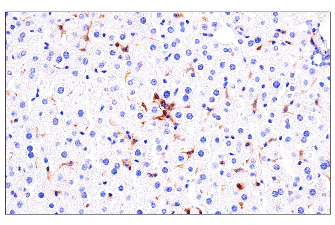 Immunohistochemistry Image 4: Axl (E3Z2H) Rabbit mAb