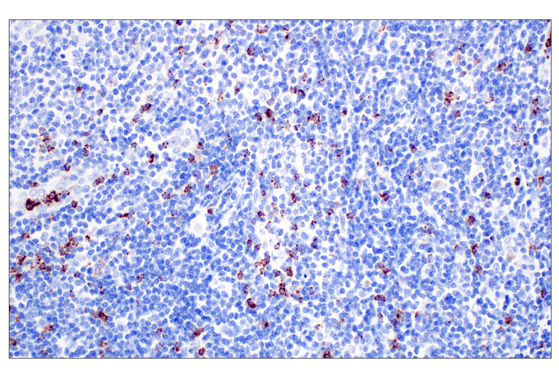 Immunohistochemistry Image 1: NKG7 (F4V5I) Rabbit mAb (BSA and Azide Free)