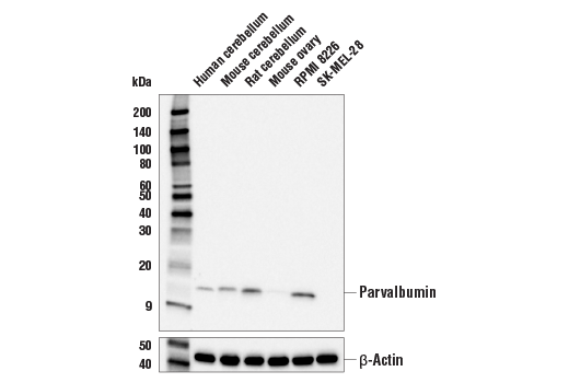 Western Blotting Image 1: Parvalbumin (E8N2U) XP<sup>®</sup> Rabbit mAb