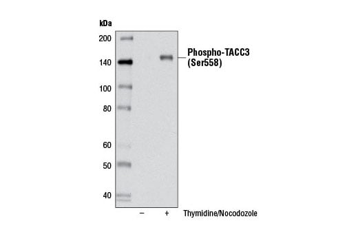 Western Blotting Image 1: Phospho-TACC3 (Ser558) (D8H10) XP<sup>®</sup> Rabbit mAb