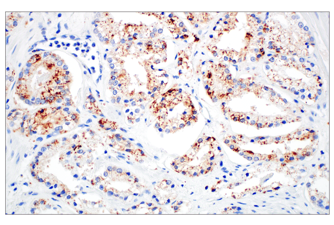 Immunohistochemistry Image 10: Perilipin-2 (E6G6M) Rabbit mAb