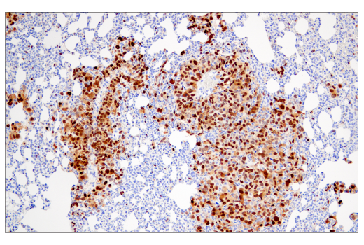 Immunohistochemistry Image 4: Cyclin D1 (E3P5S) XP<sup>®</sup> Rabbit mAb (BSA and Azide Free)
