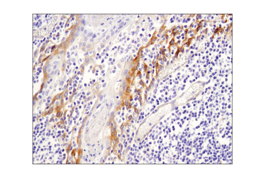 Immunohistochemistry Image 4: Jagged1 (D4Y1R) XP<sup>®</sup> Rabbit mAb